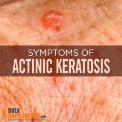 Keratosis actinic keratoses actinique kératose